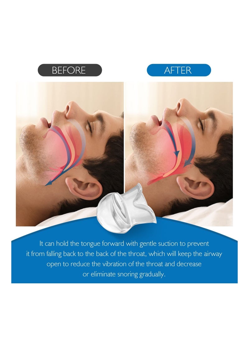 Bluejw Anti-snoring tongue cover anti-snoring device, silicone mouth type give the family a better sleeping environment,nostril stopper - Image 4