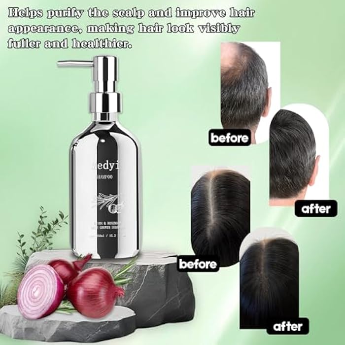 Onion Rosemary Shampoo – Contains Onion and Rosemary Extracts to Nourish the Scalp and Strengthen Hair Roots. Suitable for Daily Use by Men and Women (Silver) - Image 3