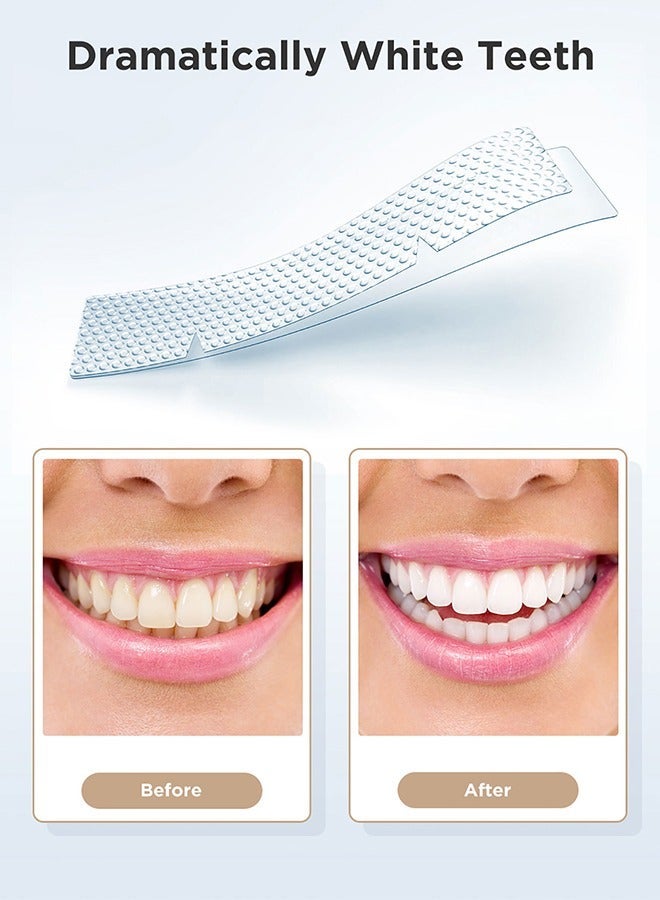 إيفيسميل مجموعة تبييض الأسنان 5D مكونة من 28 قطعة، شرائط تبييض الأسنان للحساسية، تأثيرات احترافية، 28 شريط تبييض آمن، إزالة البقع العميقة وتبييض الأسنان - Image 3