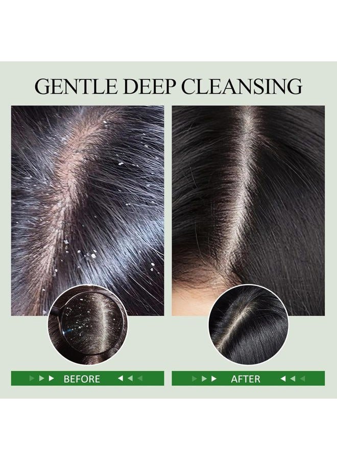 SHVYOG Scalp Scrub, Rosemary Scalp Exfoliator for Build Up, Hair Exfoliate Scrub for Scalp, Hair Treatment Nourishing Detox Hair Care with Scalp Massager - Image 4