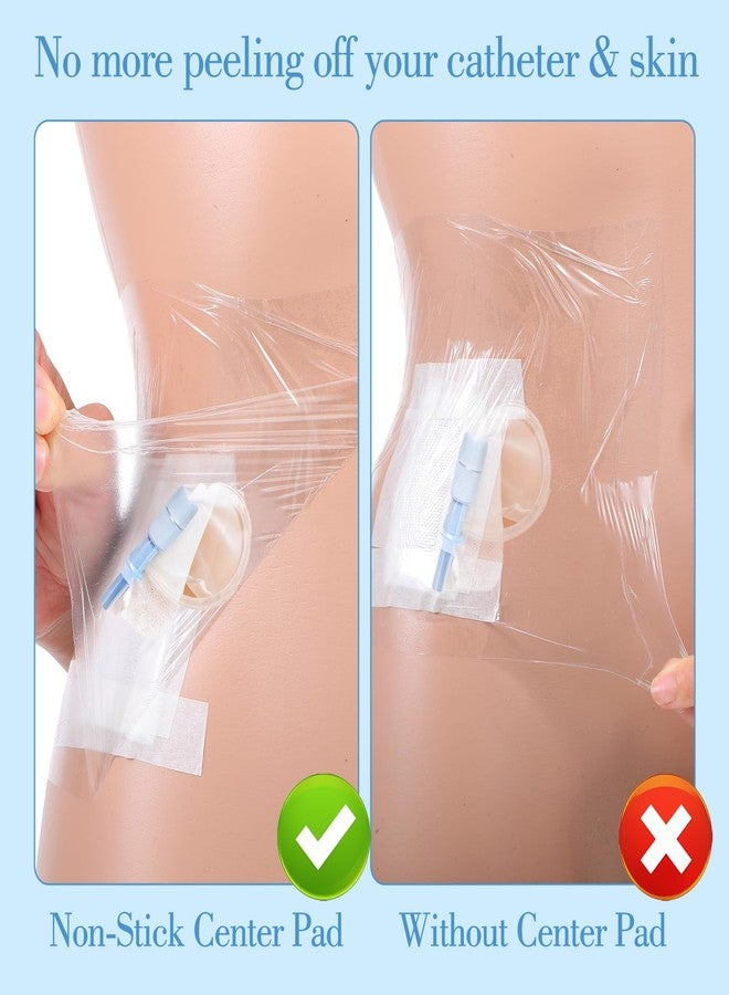 Wanmu 40Pcs Ostomy Shower Cover Waterproof, Dialysis Catheter Shields for Showering Stoma Large Coverage Catheter Covers, Adhesive Bandage with Non-Stick Pad for Showering (10" x 12") - Image 5