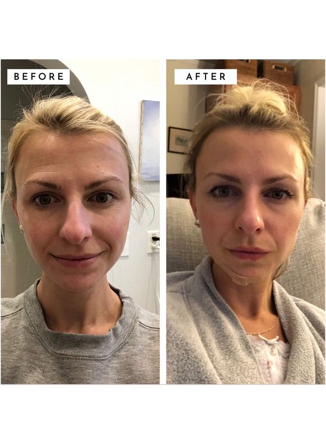 DIME Beauty Tbt Anti Aging Facial Serum Retinol Alternative With Resveratrol Mandelic Acid And Niacinamide Decrease Fine Lines Helps Skin Tighten And Hide Wrinkles Dark Spots And Crows Feet 1 Count - Image 4