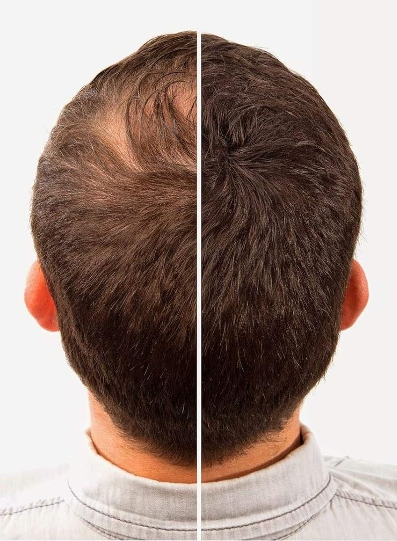 NITRO CINEMA Hair Building Fibers Dark Brown 22 g - Image 2