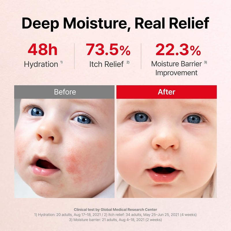 أتوبالم MLE Eczema Cream, 5.6 fl oz (160ml) | Baby Face Cream and Body Moisturizer | Skin Barrier Care | Sensitive Dry Skin Hydration | Eczema Cream for Sensitive Skin - Image 4