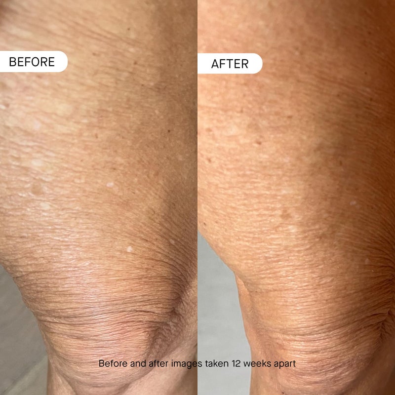 OneSkin BODY OS-01 Peptide Topical Supplement & Skin Longevity Age Reversal Moisturizer | Safe for Sensitive Skin, Fragrance-Free, 250 mL / 8.45 oz - Image 4