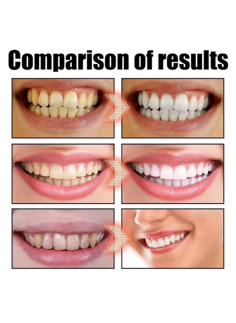 SP-4 Super Whitening Toothpaste, SP-4 Probiotic Whitening Toothpaste, Probiotic Whitening Toothpaste, SP-4 Paste Oral Health Management, Fresh Breath (Red) - Image 4