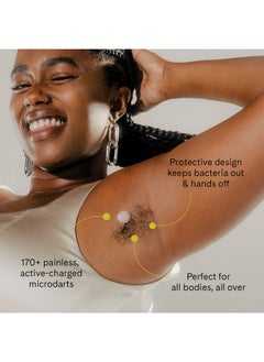 Fur Ur Ingrown Microdart Patches Ingrown Hair Care Quickly And Effectively Clear Up Ingrown Hair Bumps 6 Pack  - Image 3