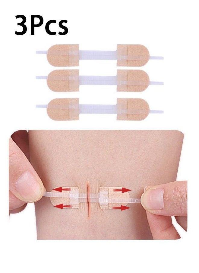 GMORO 3 Pcs Zip Stitch Wound Closure Device Emergency Zipstitch Laceration Kit Bandages with sterile Strips Painless Laceration Repair Without Stitches Wound Care First Aid  - Image 1