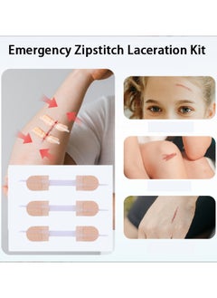 3 Pcs Zip Stitch Wound Closure Device Emergency Zipstitch Laceration Kit Bandages with sterile Strips Painless Laceration Repair Without Stitches Wound Care First Aid - pzsku/ZB0C7455B5FBC2D694333Z/45/_/1732783392/9650320e-cda3-431e-9023-1b06ca223afb