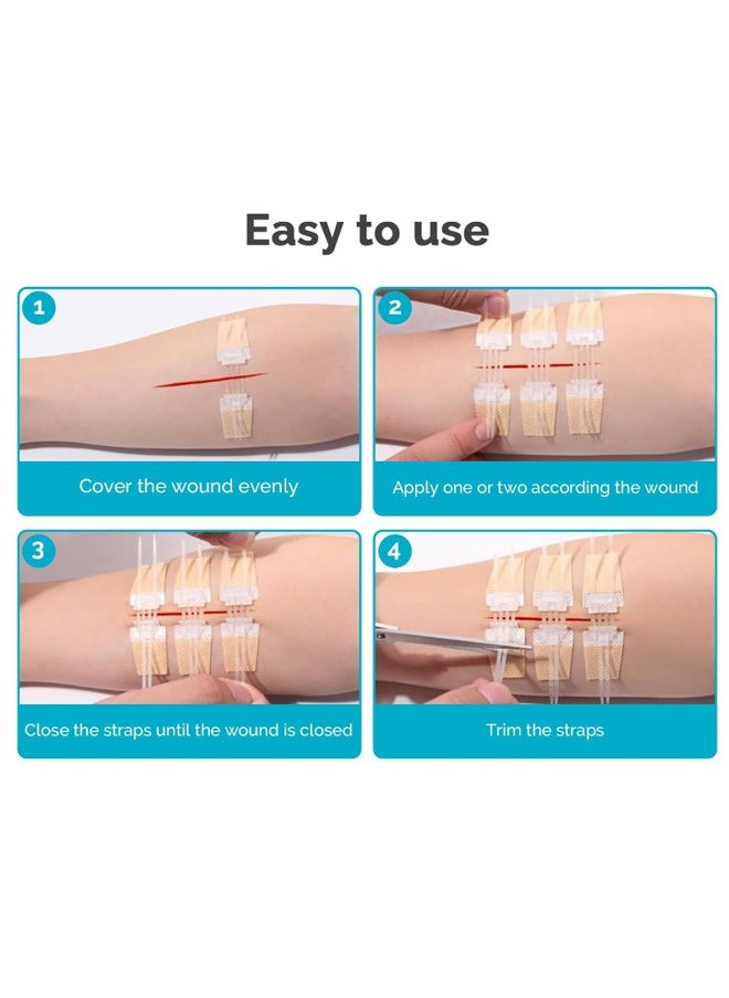 GMORO 3 Pcs Zip Stitch Wound Closure Device Emergency Zipstitch Laceration Kit Bandages with sterile Strips Painless Laceration Repair Without Stitches Wound Care First Aid  - Image 4