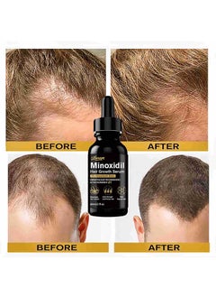 LUNOON 5% Minioxidil Hair Growth Serum for with Biotin Regrowth Hair Treatment For Thickens Hair Promotes Hair Density Help to Stop Thinning loss Hair stimulates Hair Growth, Regain Hair Serum-60ml  - Image 3