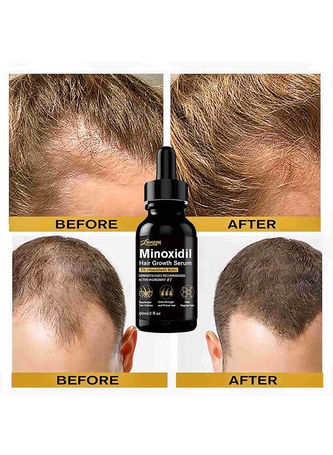 LUNOON 5% Minioxidil Hair Growth Serum for with Biotin Regrowth Hair Treatment For Thickens Hair Promotes Hair Density Help to Stop Thinning loss Hair stimulates Hair Growth, Regain Hair Serum-60ml - Image 3