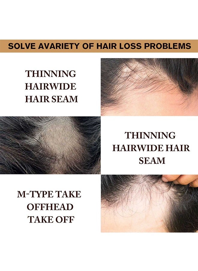 LUNOON 5% Minioxidil Hair Growth Serum for with Biotin Regrowth Hair Treatment For Thickens Hair Promotes Hair Density Help to Stop Thinning loss Hair stimulates Hair Growth, Regain Hair Serum-60ml - Image 4