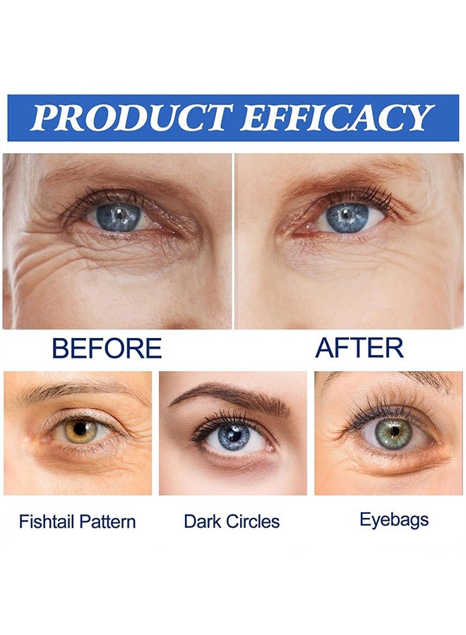 EELHOE Dissolving Microneedle Patches,Microglow Eye Patches,Anti Wrinkle Patches,Dissolving Microneedle Wrinkle Patches,Microglow Patches with Hyaluronic Acid & Collagen,under Eye Patches，6 Pieces - Image 3