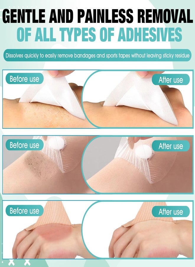 OverZyn 2 Oz Skin Adhesive Remover, Bandage Adhesive Remover, Mild Quick Peeling - Image 5