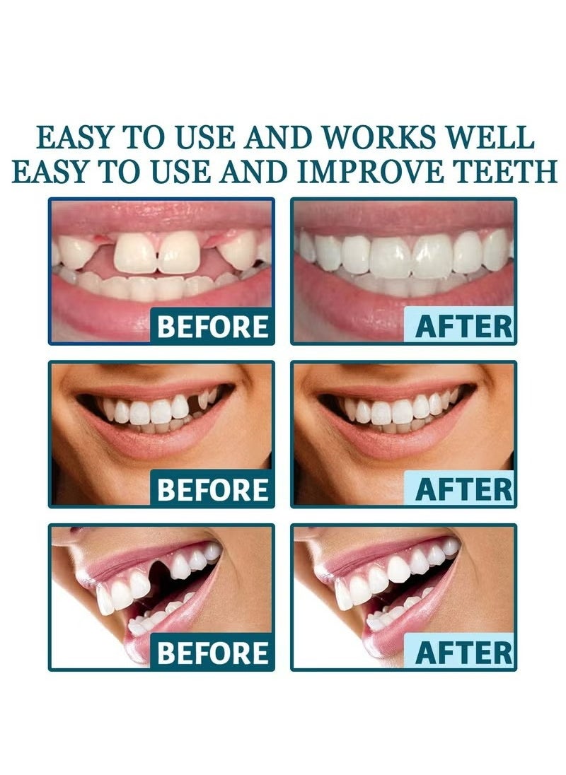 EELHOE - 1 Pairs Temporary Teeth Perfect Cover, Cosmetic Veneers Teeth Temporary Dentures, Adjustable Snap On, Moldable False Teeth for Beautiful Smile, Nature and Comfortable, Fit Whitening Flex Denture Cover，Teeth Veneers Whitening Dentures - Image 1