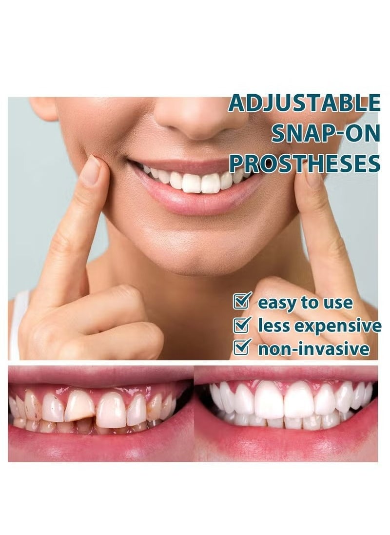 EELHOE - 1 Pairs Temporary Teeth Perfect Cover, Cosmetic Veneers Teeth Temporary Dentures, Adjustable Snap On, Moldable False Teeth for Beautiful Smile, Nature and Comfortable, Fit Whitening Flex Denture Cover，Teeth Veneers Whitening Dentures - Image 1