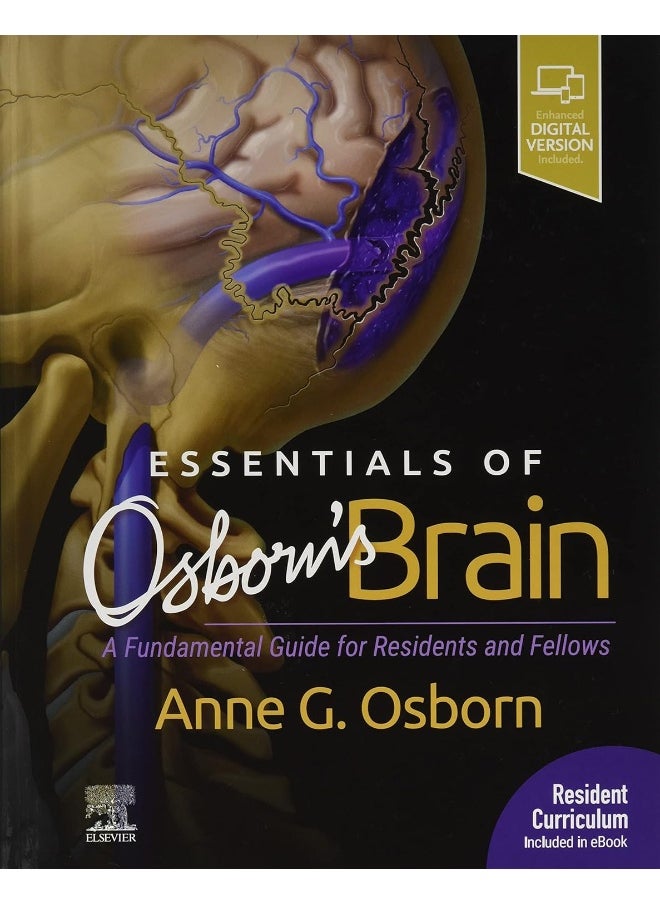 Essentials of Osborn's Brain: A Fundamental Guide for Residents and Fellows  - Image 1