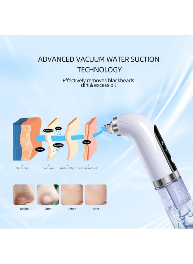 Electric Blackhead Remover Pore Vacuum Water Circulatio Cleaner Pimple Extractor Blackheadwith 3 Suction Levels 6 Attachments for Facial Cleansing and Skin Refinement USB Rechargeable Gentle Suction - Image 2