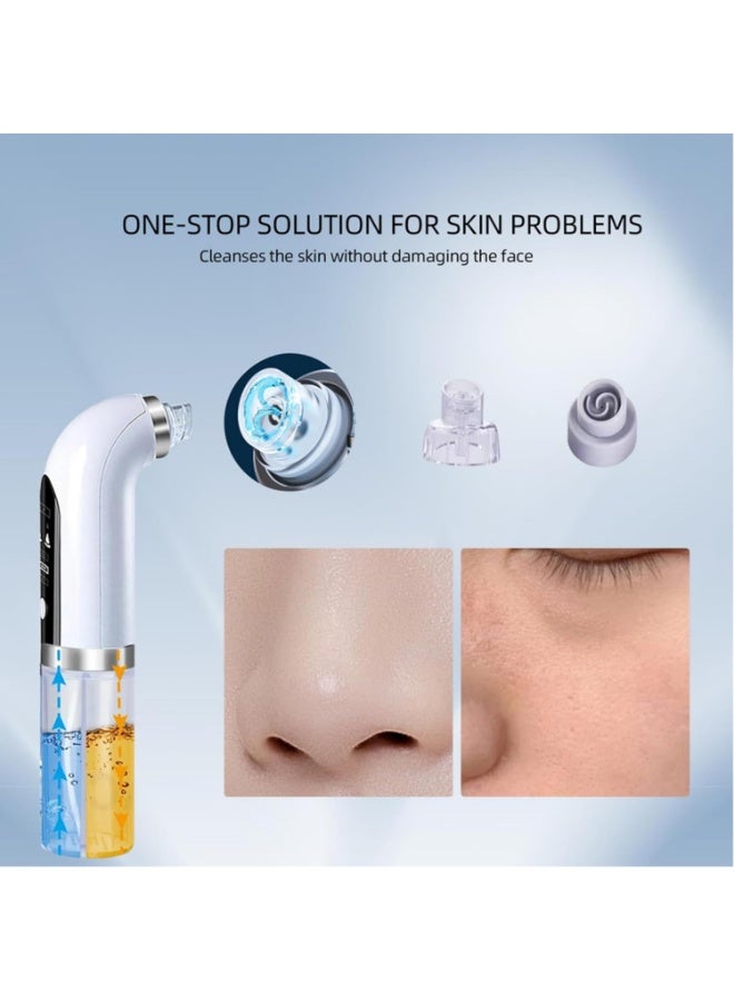Electric Blackhead Remover Pore Vacuum Water Circulatio Cleaner Pimple Extractor Blackheadwith 3 Suction Levels 6 Attachments for Facial Cleansing and Skin Refinement USB Rechargeable Gentle Suction - Image 4