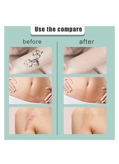SOUTH MOON Multi Purpose Scar Sheets Soft Breathable Skin Color Easy Tear Tape,Complexion Concealer Patches , Skin Scar Tattoos Acne Scar Patches -,Waterproof Complexion Patches  - Image 4