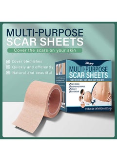 SOUTH MOON Multi Purpose Scar Sheets Soft Breathable Skin Color Easy Tear Tape,Complexion Concealer Patches , Skin Scar Tattoos Acne Scar Patches -,Waterproof Complexion Patches  - Image 3