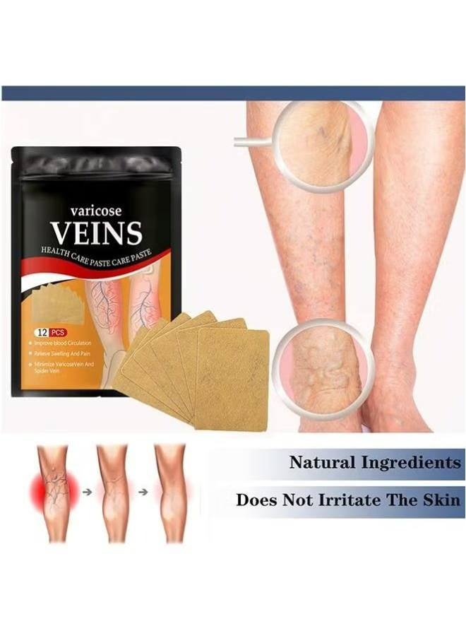 ساوث مون 12 قطعة لعلاج دوالي الساقين، رقعة علاج لإزالة دوالي الساقين، رقعة دوالي الساقين، تخفيف آلام الساق، تقوية صحة الشعيرات الدموية وتحسين الدورة الدموية - Image 3