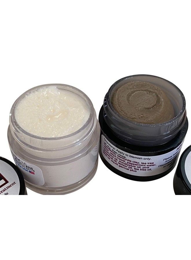 Diva Stuff Earth Stuff Acne Spot Treatment Two Pack Vanishing Cream And Cystic Spot By Diva Stuff - Image 4