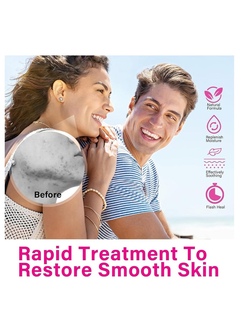SOUTH MOON - Azelaic Acid Serum 12% - Facial Serum with Niacinamide & Vitamin C - Redness Relief, Dark Spot Corrector - Hyaluronic Acid & Niacinamide for Acne & Rosacea - Balances Excess Sebum (20g) - Image 1