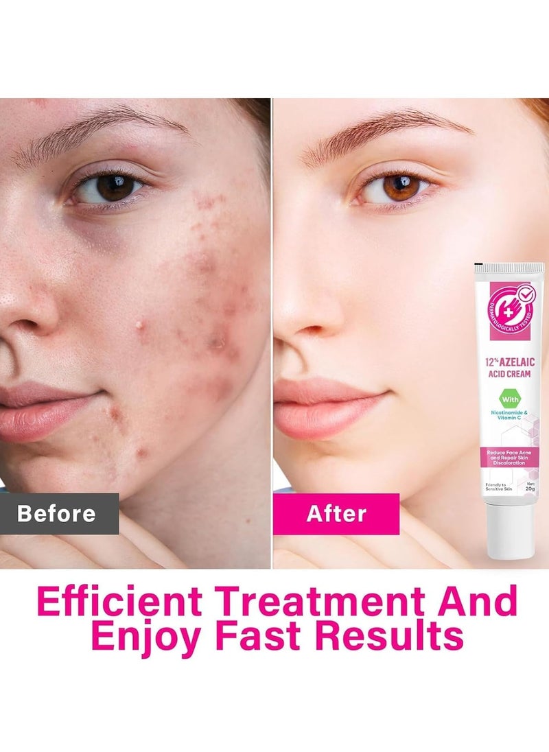 SOUTH MOON - Azelaic Acid Serum 12% - Facial Serum with Niacinamide & Vitamin C - Redness Relief, Dark Spot Corrector - Hyaluronic Acid & Niacinamide for Acne & Rosacea - Balances Excess Sebum (20g) - Image 1
