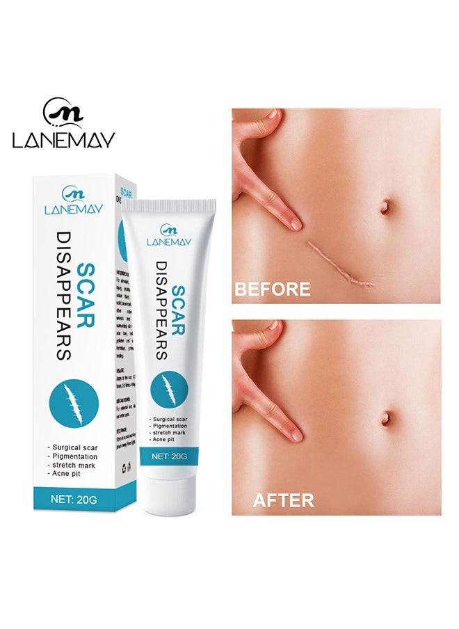 LANEMAY Scar Cream, Medical Grade Silicone Scar Cream Advanced Scar Removal Gel For Surgical Scars Stretch Marks Acne Injury Burns Keloids Hypertrophic Old And New Scars 20 g  - Image 1