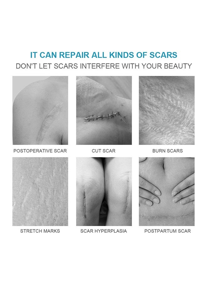 LANEMAY Scar Cream, Medical Grade Silicone Scar Cream Advanced Scar Removal Gel For Surgical Scars Stretch Marks Acne Injury Burns Keloids Hypertrophic Old And New Scars 20 g  - Image 5