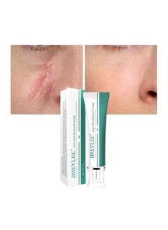 Breylee Acne Scar Removal Cream 30grams  - Image 4