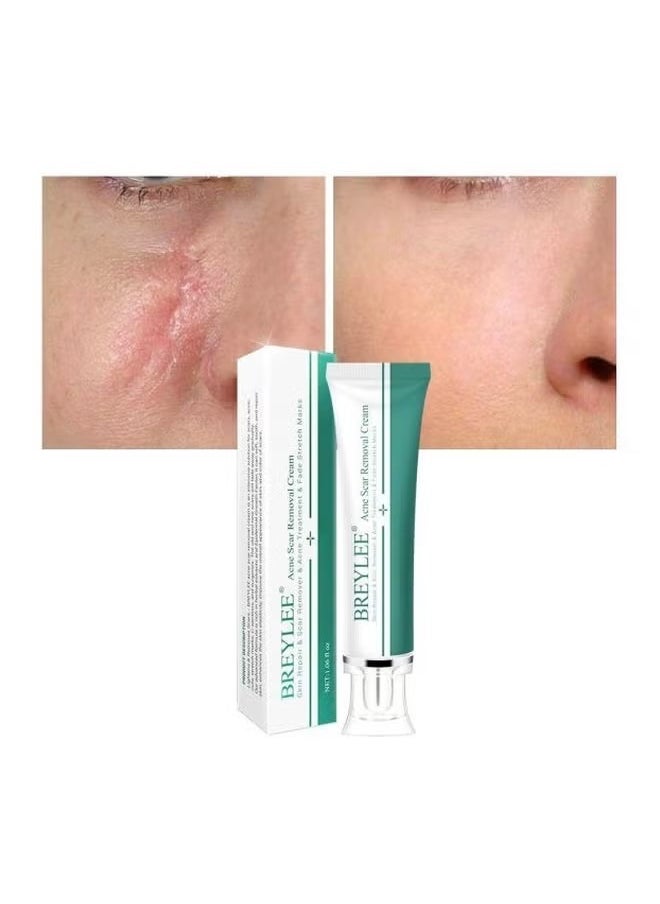 Breylee Acne Scar Removal Cream 30grams  - Image 4