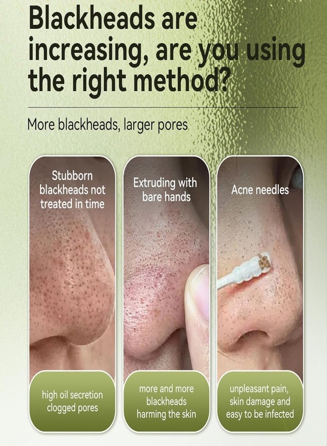 Vemofoper Blackhead Remover Mask. Upgraded 2.0 Plant-based formula deeply cleans pores, removes blackheads & excess oil. Gentle for all skin type - Image 5