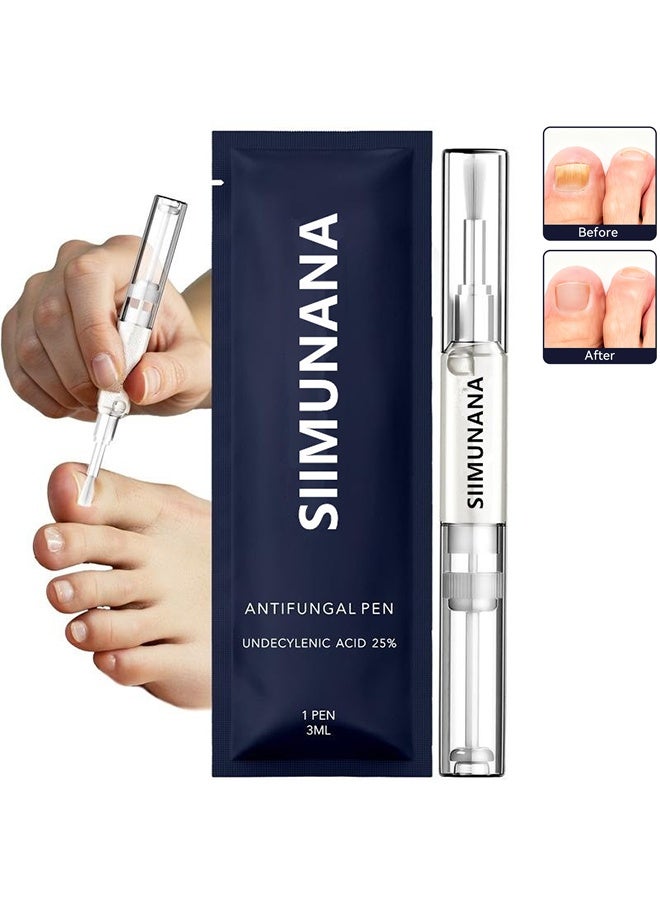 siimunana Antifungal pen, Undecylenic acid 25% Nail Fungus Treatment Pen, Fast-Acting Solution for Toe & Fingernail Fungi, Ideal for Nail Health Concerns Athletes - Image 1