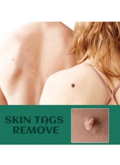 iBealee Skin Tag Remover Pen Fast Skin Tag Removal Effective Safe for Face and Body Tags Mole Wart Skin Tag Remover Serum Painless No Scars Easy Use Wart Remover Liquid  - Image 2