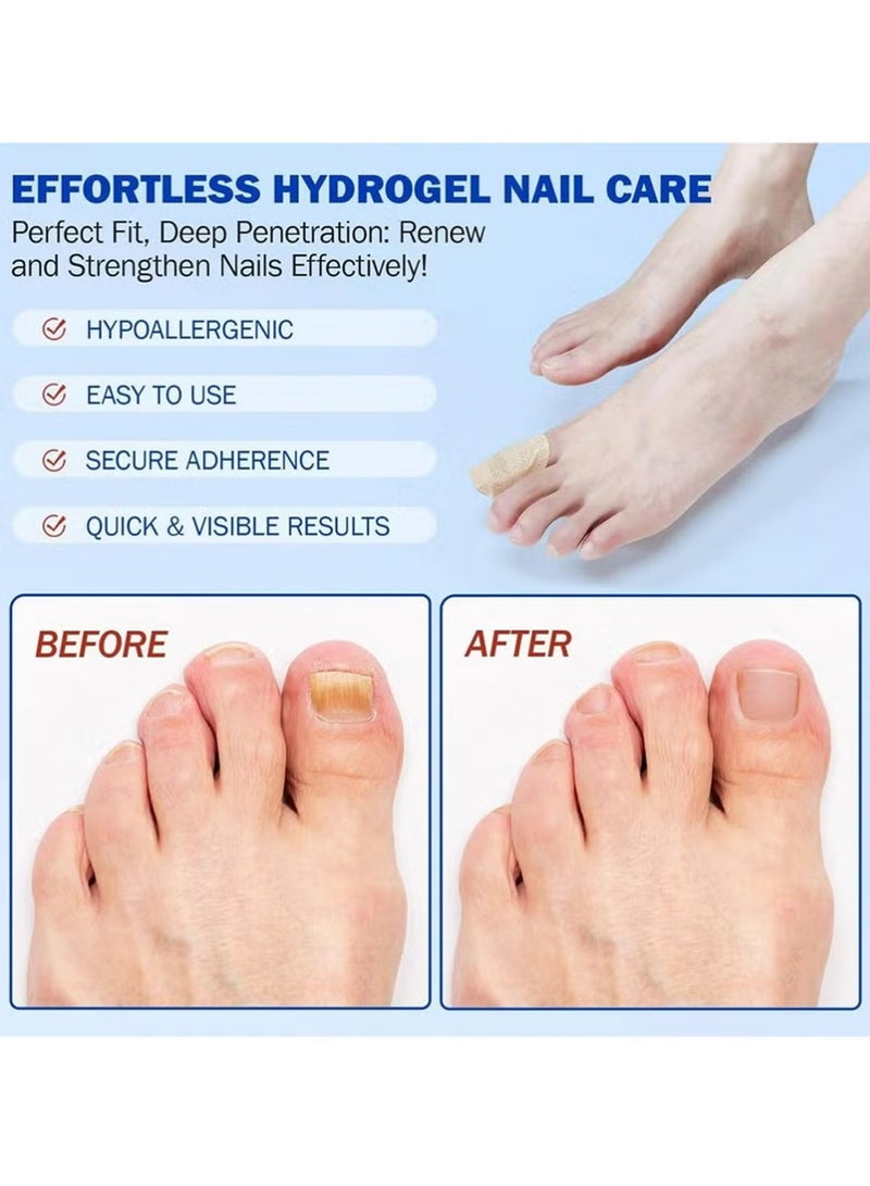 Fungal Nail Repair Patches – Effective Care Solution for Healthy, Strong Toenails. Easy-to-Use, Fast-Acting & Long-Lasting Results - Image 4