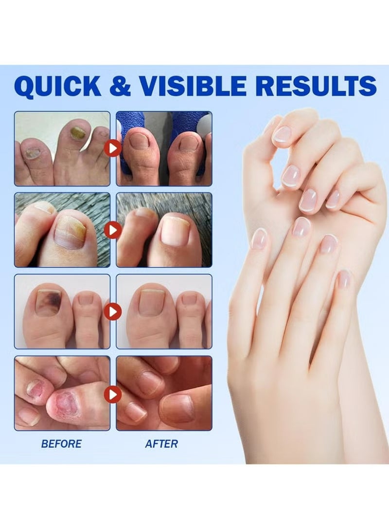 Fungal Nail Repair Patches – Effective Care Solution for Healthy, Strong Toenails. Easy-to-Use, Fast-Acting & Long-Lasting Results - Image 3