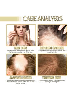 EELHOE Hair Growth Oil, Rosemary Hair Growth Essential Oil, Anti Hair Loss Fast Regrowth Essence, Repair Damaged Frizzy Thinning Scalp Hair-restorer Dense, Hair Growth Serum, 60ml/2 fl.oz  - Image 4
