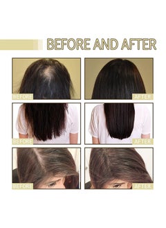 EELHOE Hair Growth Oil, Rosemary Hair Growth Essential Oil, Anti Hair Loss Fast Regrowth Essence, Repair Damaged Frizzy Thinning Scalp Hair-restorer Dense, Hair Growth Serum, 60ml/2 fl.oz  - Image 5