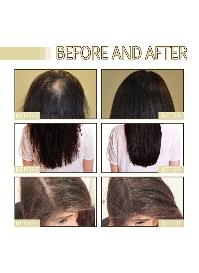 EELHOE - Hair Growth Oil, Rosemary Hair Growth Essential Oil, Anti Hair Loss Fast Regrowth Essence, Repair Damaged Frizzy Thinning Scalp Hair-restorer Dense, Hair Growth Serum, 60ml/2 fl.oz - Image 1