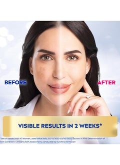 Nivea Anti-Dark Circles & Puffiness Eye Serum with Hydrating Hyaluronic Acid & Energizing Caffeine, 15ml  - Image 2