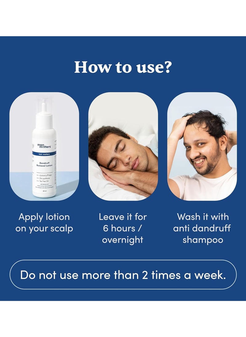 Anti Dandruff Lotion for Men 60ml - Instant Itch Relief and Cooling with Menthol and Tea Tree Oil