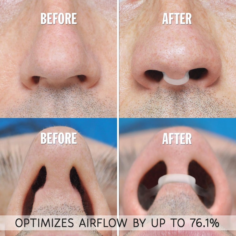 AIR MAX AIRMAX Nasal Dilator for Better Sleep - Natural, Comfortable, Anti Snoring Device, Snoring Solution for Maximum Airflow and Easier Breathing (Medium - Clear) - Image 4