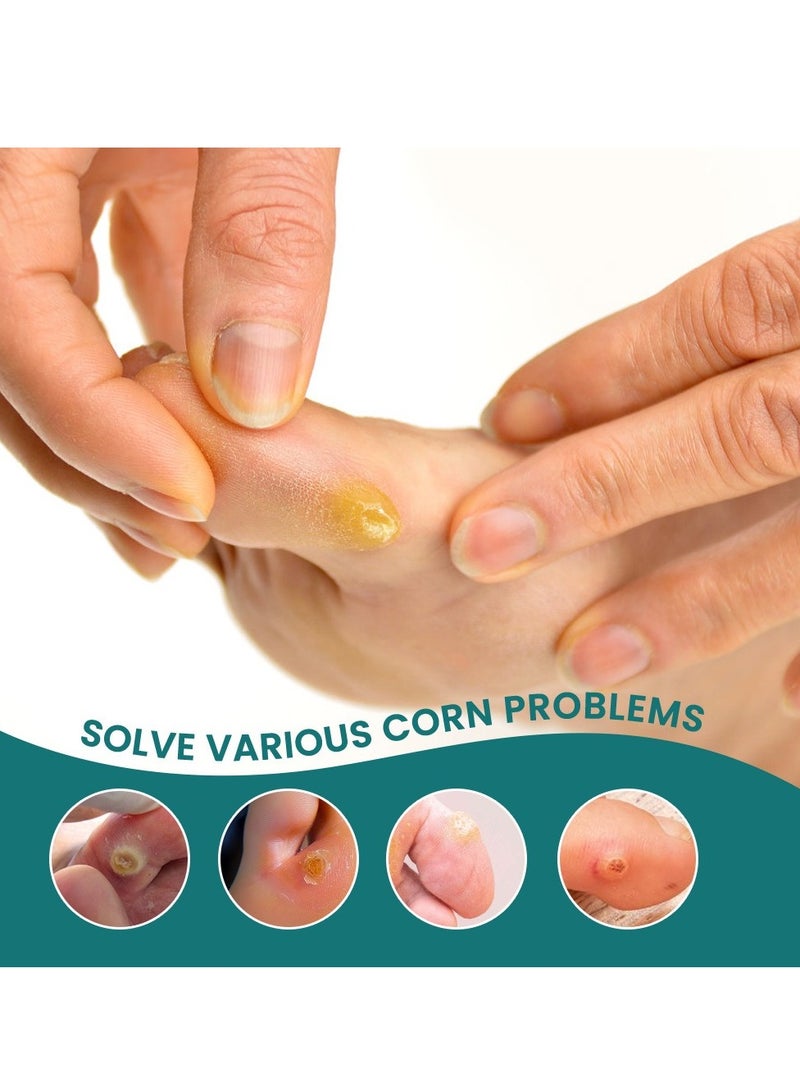 سوميفون علاج إزالة مسامير القدم وتخفيف آلام مسامير القدم والعناية بالقدم، ضمادات قدم لإزالة الثآليل الأخمصية بقوة قصوى بخطوة واحدة، 54 قطعة - Image 2