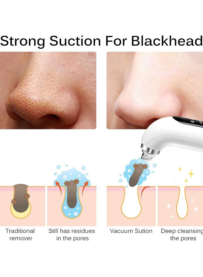 general Blackhead Remover Pore Vacuum Facial Cleaner 6 Suctions USB Rechargeable Facial Cleaning Tools - Image 2