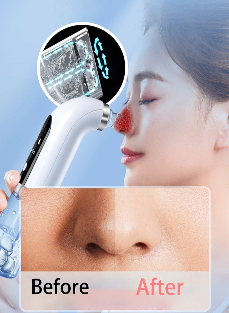general Blackhead Remover Pore Vacuum Facial Cleaner 6 Suctions USB Rechargeable Facial Cleaning Tools - Image 3