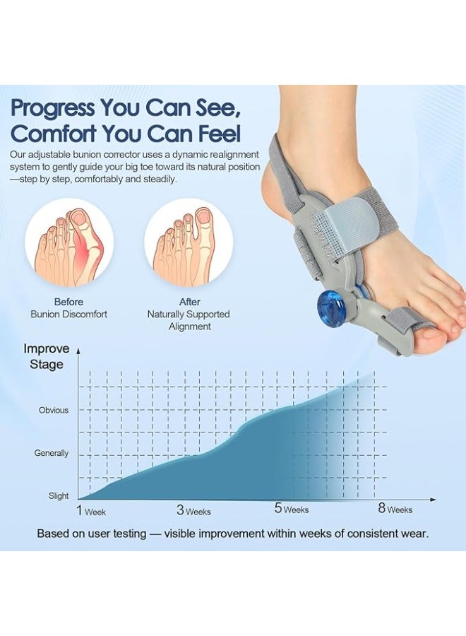 Bunion Corrector with Adjustable Knob for Big Toe – Precision Bunion Relief Fix with Silicone Pad – Easy-to-Use for Men & Women (Left/Right Foot) - Image 3
