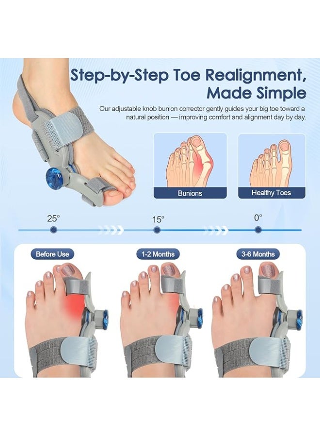 Bunion Corrector with Adjustable Knob for Big Toe – Precision Bunion Relief Fix with Silicone Pad – Easy-to-Use for Men & Women (Left/Right Foot) - Image 4